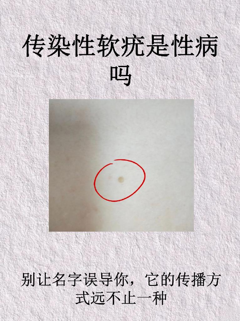 水猴子是什么东西/水猴子是什么东西形成的-第1张图片