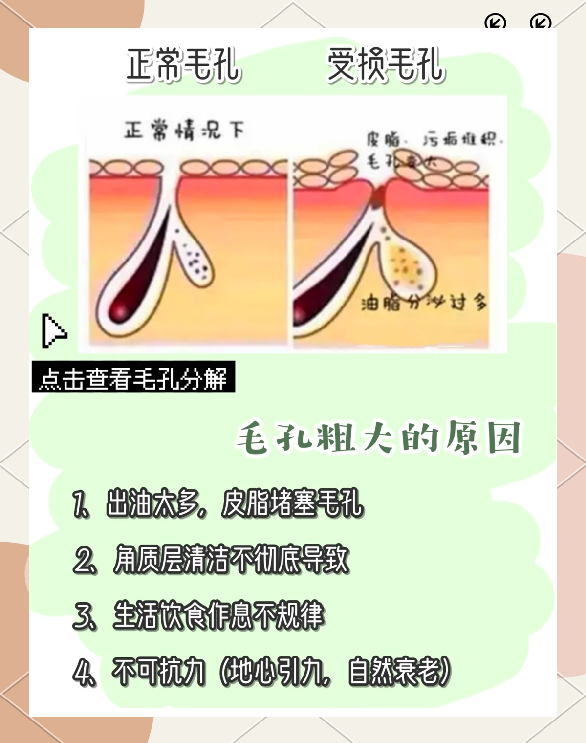 【毛孔粗大怎么办,脸上毛孔粗大怎么办】-第2张图片